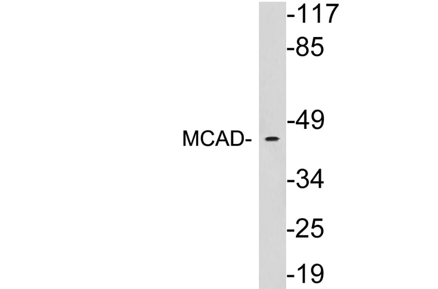 Western Blot - Anti-MCAD Antibody (R12-2235) - Antibodies.com