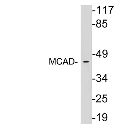 Western Blot - Anti-MCAD Antibody (R12-2235) - Antibodies.com