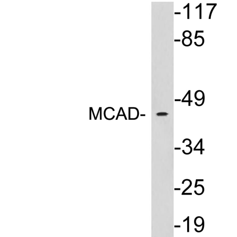 Western Blot - Anti-MCAD Antibody (R12-2235) - Antibodies.com