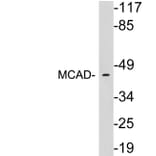 Western Blot - Anti-MCAD Antibody (R12-2235) - Antibodies.com