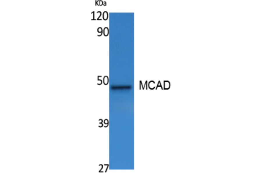 Western Blot - Anti-MCAD Antibody (R12-2235) - Antibodies.com