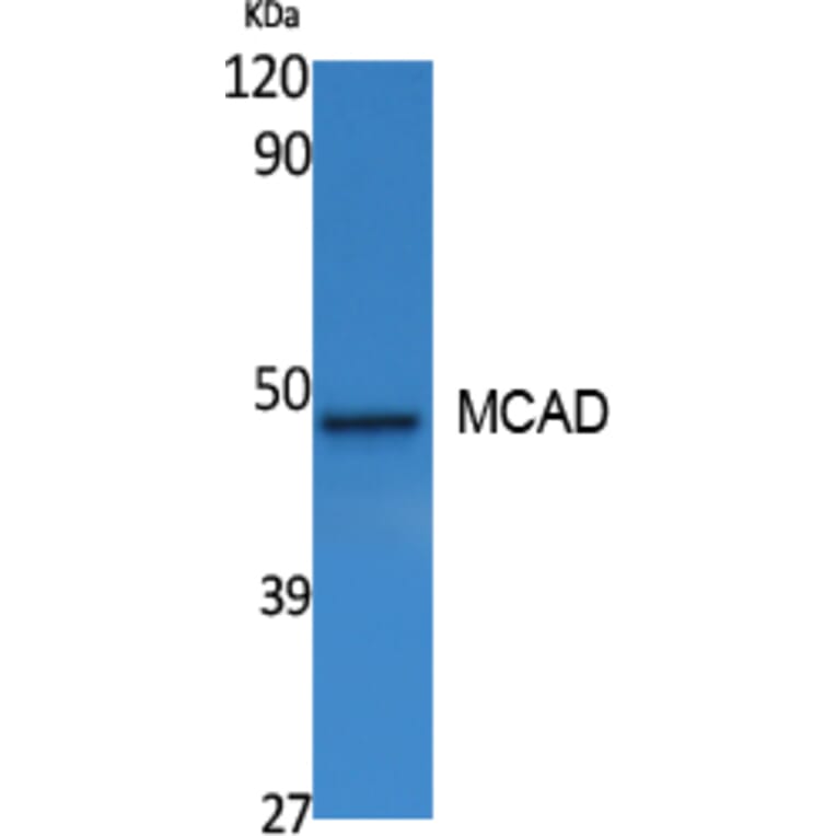 Western Blot - Anti-MCAD Antibody (R12-2235) - Antibodies.com