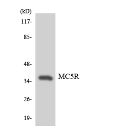 Western Blot - Anti-MC5R Antibody (R12-3004) - Antibodies.com