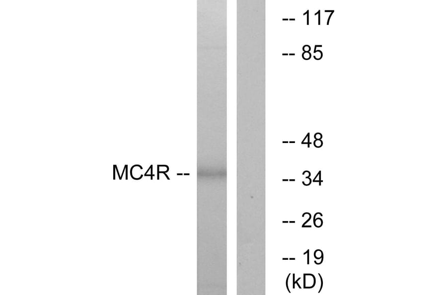 Western Blot - Anti-MC4R Antibody (G384) - Antibodies.com