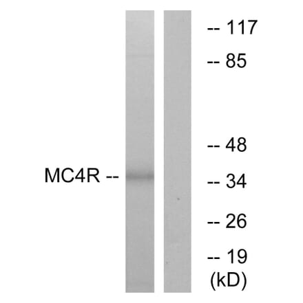 Western Blot - Anti-MC4R Antibody (G384) - Antibodies.com