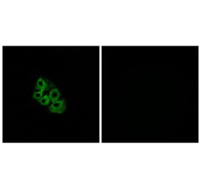 Immunofluorescence - Anti-LSHR Antibody (G380) - Antibodies.com