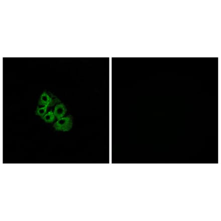 Immunofluorescence - Anti-LSHR Antibody (G380) - Antibodies.com