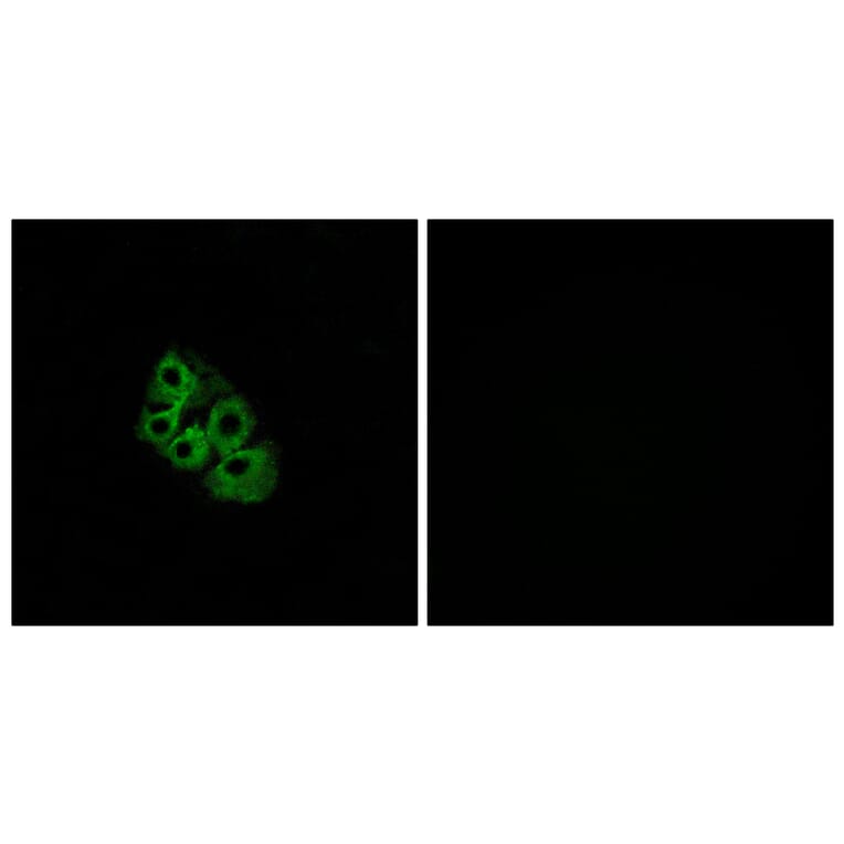 Immunofluorescence - Anti-LSHR Antibody (G380) - Antibodies.com