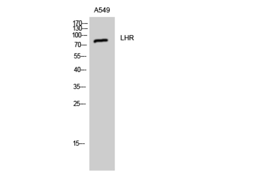 Western Blot - Anti-LSHR Antibody (G380) - Antibodies.com