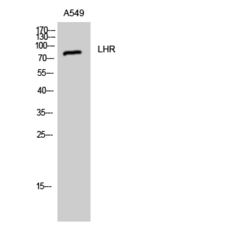 Western Blot - Anti-LSHR Antibody (G380) - Antibodies.com