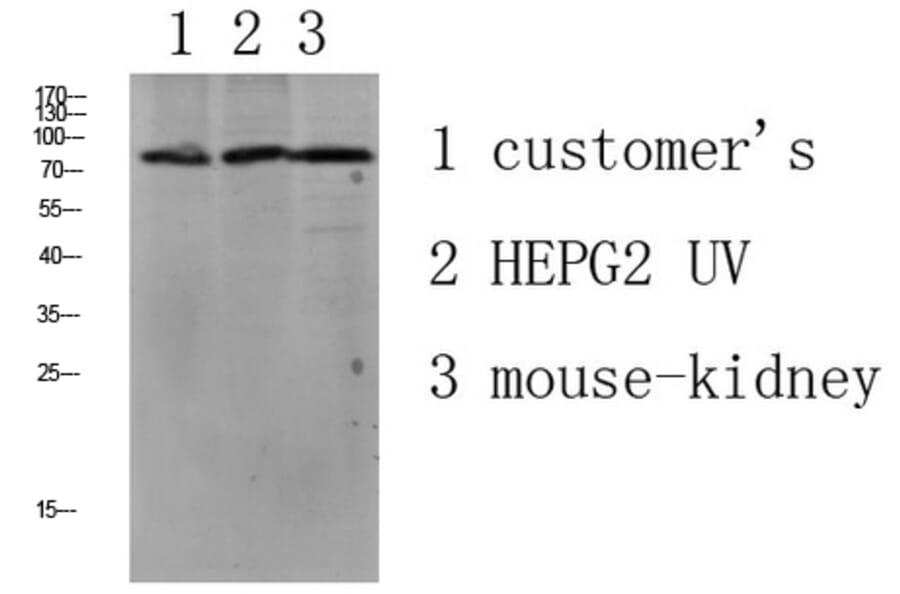Western Blot - Anti-LSHR Antibody (G380) - Antibodies.com
