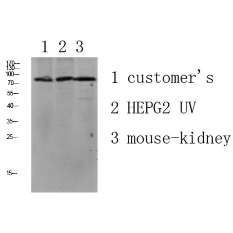 Western Blot - Anti-LSHR Antibody (G380) - Antibodies.com
