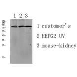 Western Blot - Anti-LSHR Antibody (G380) - Antibodies.com
