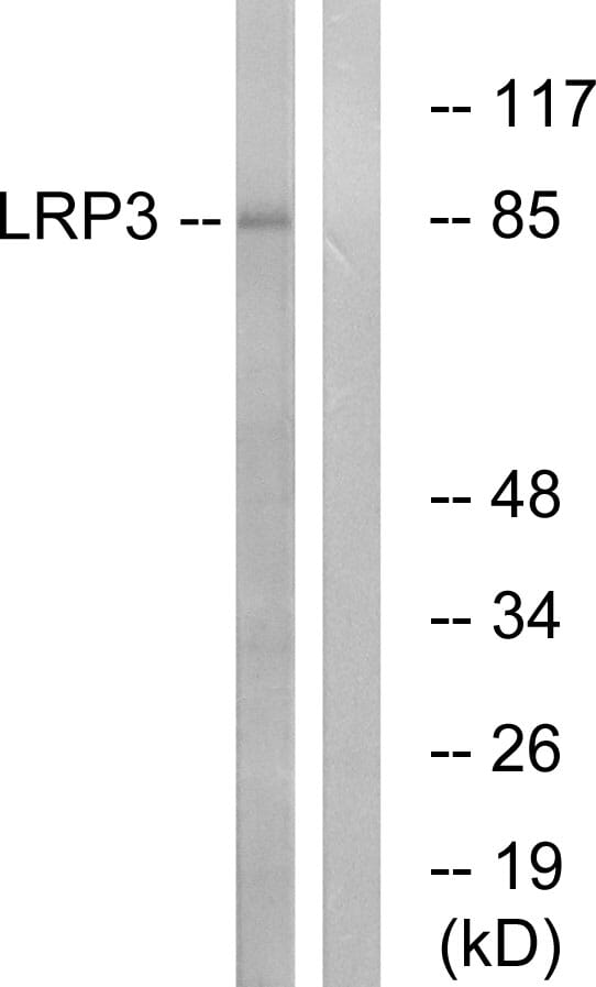 Western blot analysis of lysates from RAW264.7 cells using Anti-LRP3 Antibody. The right hand lane represents a negative control, where the antibody is blocked by the immunising peptide.