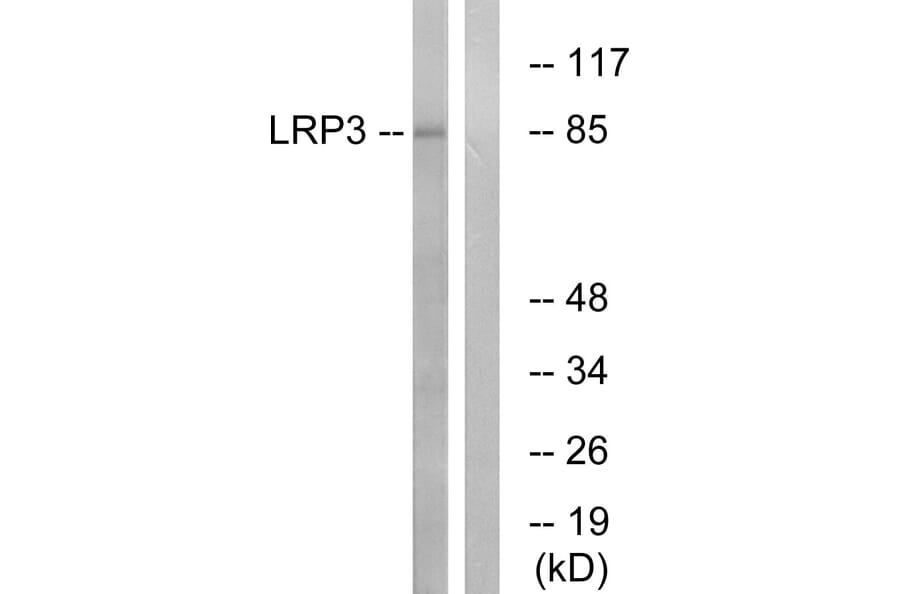Western Blot - Anti-LRP3 Antibody (C16512) - Antibodies.com