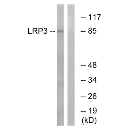 Western Blot - Anti-LRP3 Antibody (C16512) - Antibodies.com