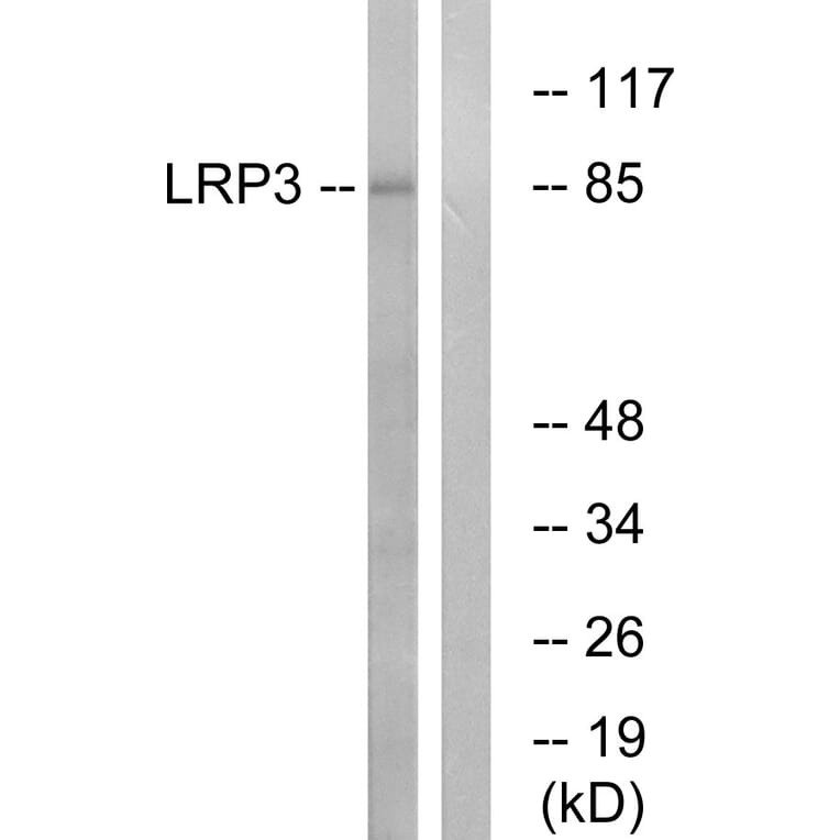 Western Blot - Anti-LRP3 Antibody (C16512) - Antibodies.com