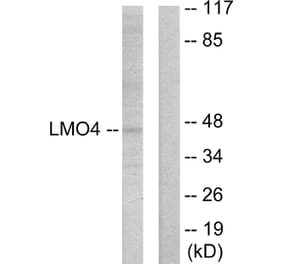 Western Blot - Anti-LMO4 Antibody (C10773) - Antibodies.com