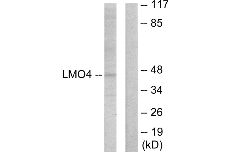 Western Blot - Anti-LMO4 Antibody (C10773) - Antibodies.com