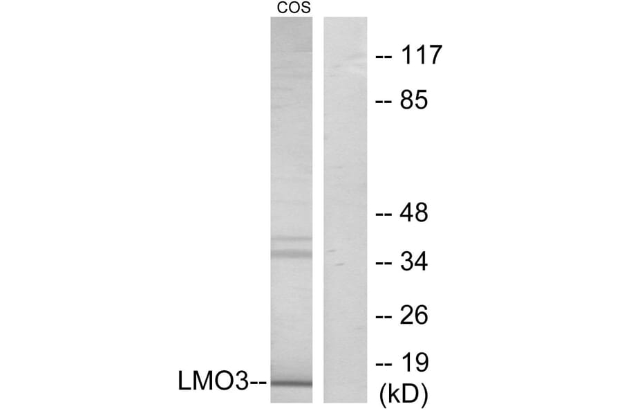 Western Blot - Anti-LMO3 Antibody (C11382) - Antibodies.com