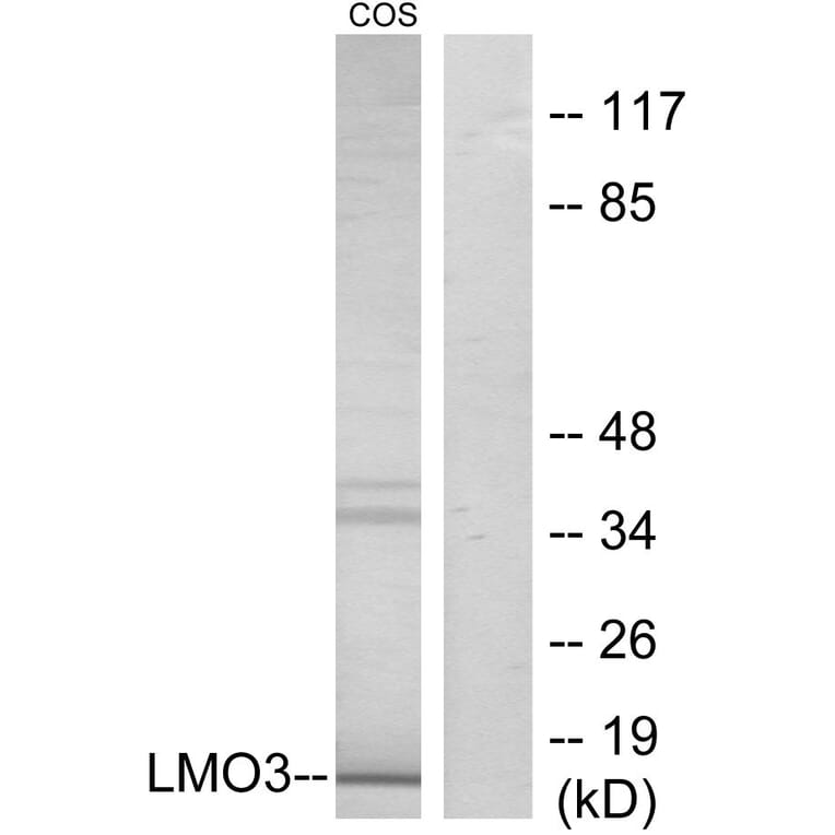 Western Blot - Anti-LMO3 Antibody (C11382) - Antibodies.com