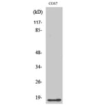 Western Blot - Anti-LMO3 Antibody (C11382) - Antibodies.com