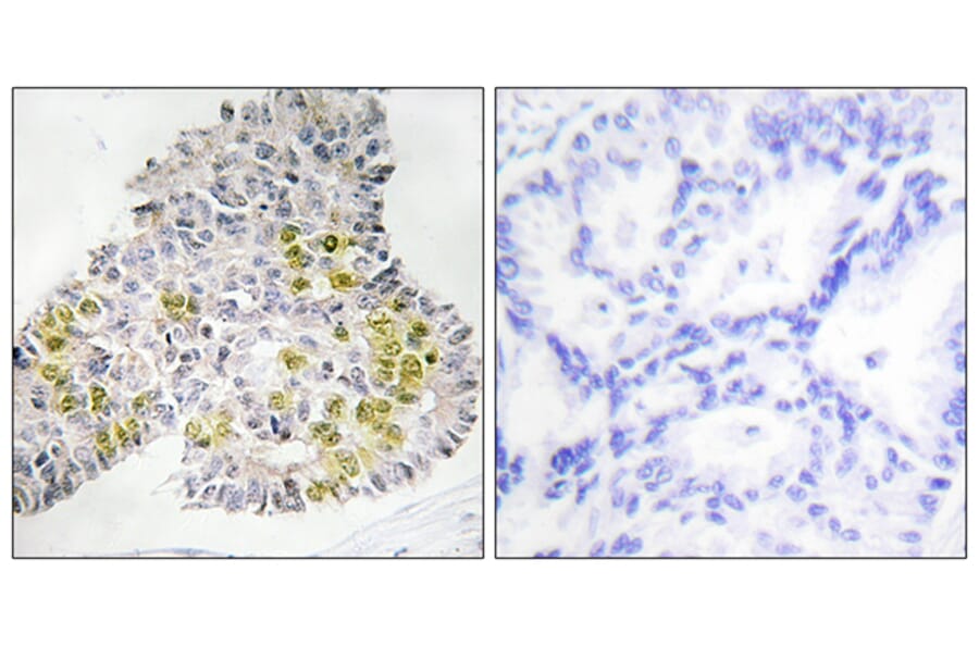 Immunohistochemistry - Anti-LKB1 Antibody (B0672) - Antibodies.com