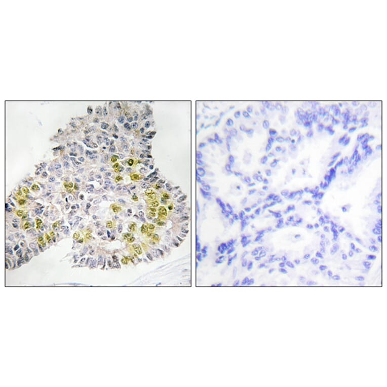 Immunohistochemistry - Anti-LKB1 Antibody (B0672) - Antibodies.com