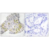 Immunohistochemistry - Anti-LKB1 Antibody (B0672) - Antibodies.com