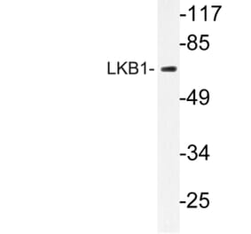 Western Blot - Anti-LKB1 Antibody (R12-2228) - Antibodies.com