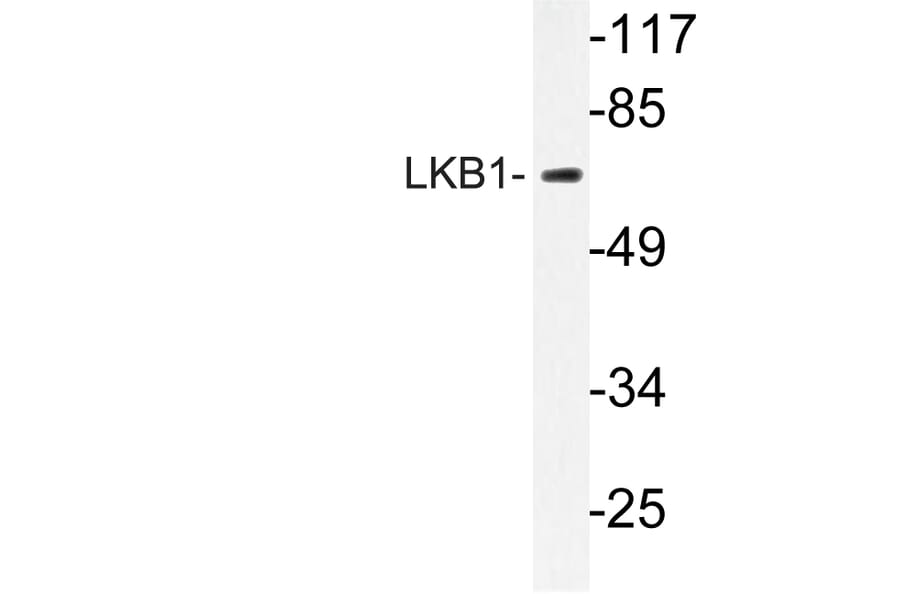 Western Blot - Anti-LKB1 Antibody (R12-2228) - Antibodies.com