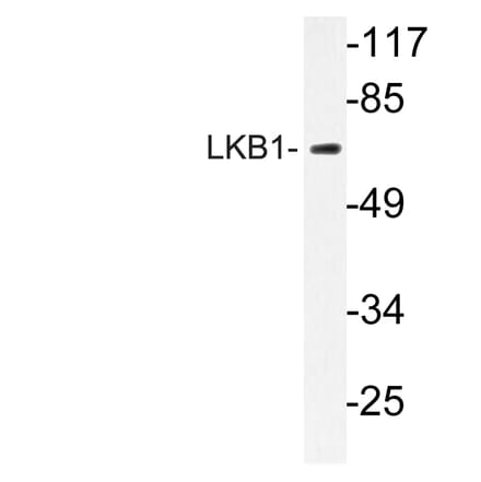 Western Blot - Anti-LKB1 Antibody (R12-2228) - Antibodies.com