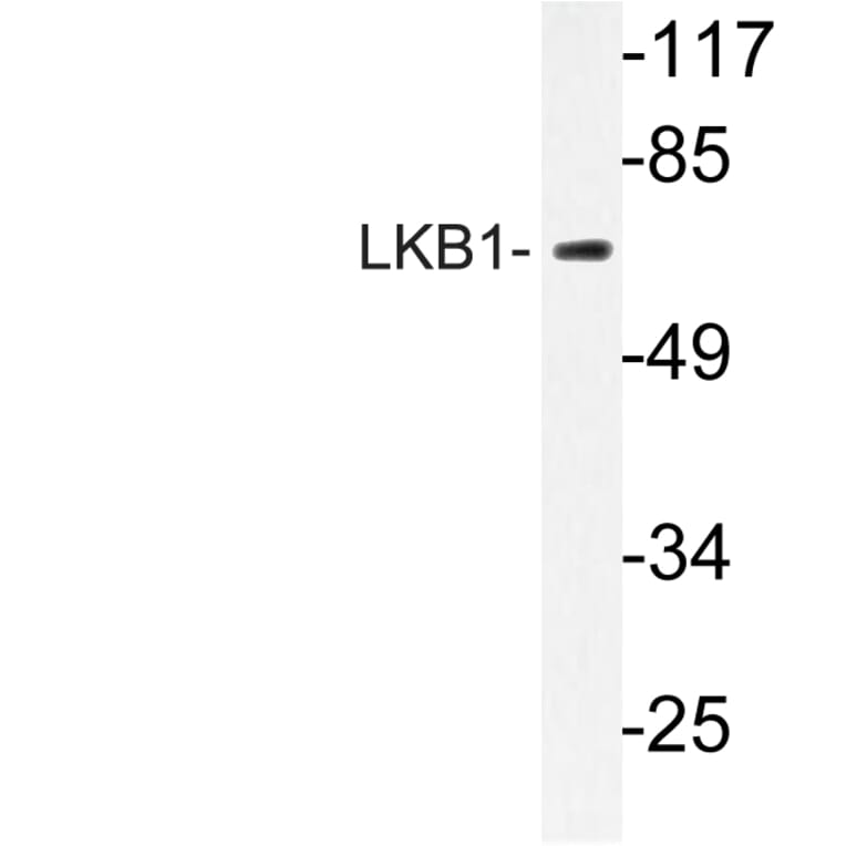 Western Blot - Anti-LKB1 Antibody (R12-2228) - Antibodies.com