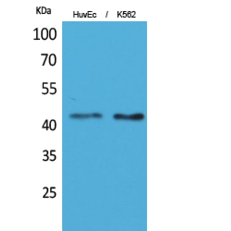 Western Blot - Anti-LAYN Antibody (C30259) - Antibodies.com