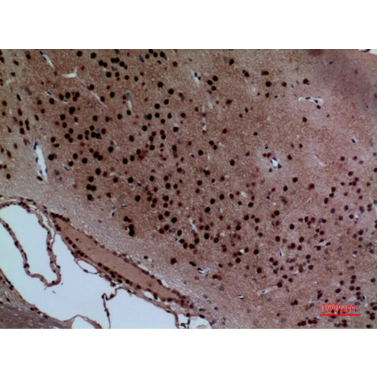 Immunohistochemistry - Anti-LAYN Antibody (C30259) - Antibodies.com