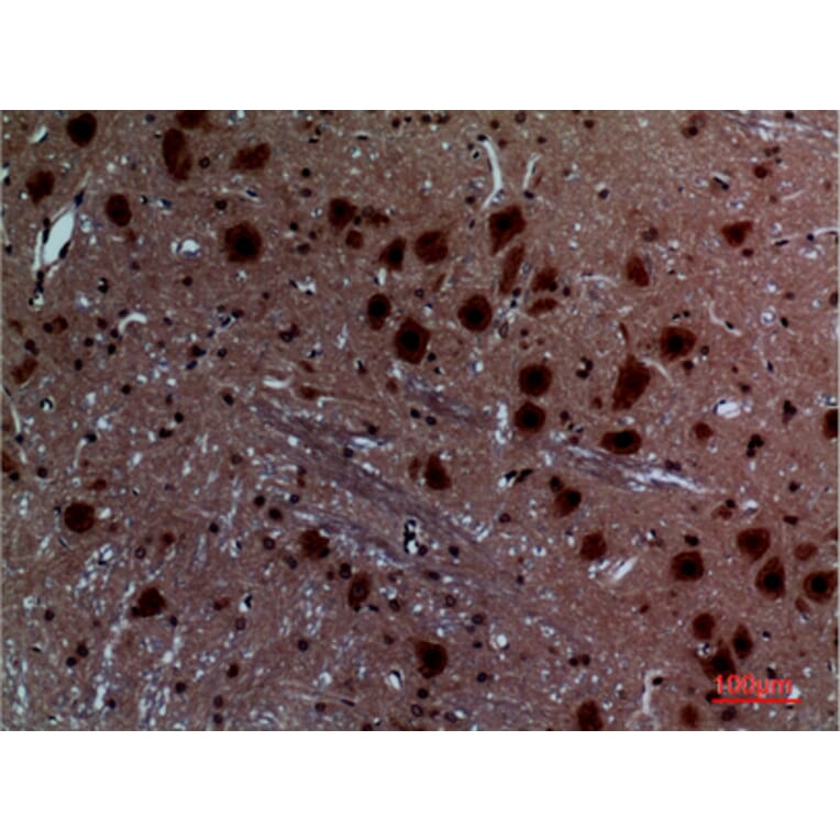Immunohistochemistry - Anti-LAYN Antibody (C30259) - Antibodies.com