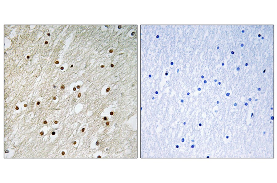 Immunohistochemistry - Anti-Ku70 Antibody (B0449) - Antibodies.com