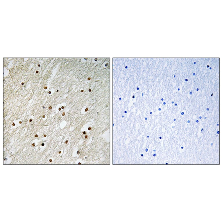 Immunohistochemistry - Anti-Ku70 Antibody (B0449) - Antibodies.com