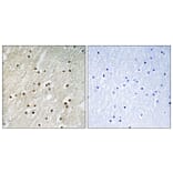 Immunohistochemistry - Anti-Ku70 Antibody (B0449) - Antibodies.com