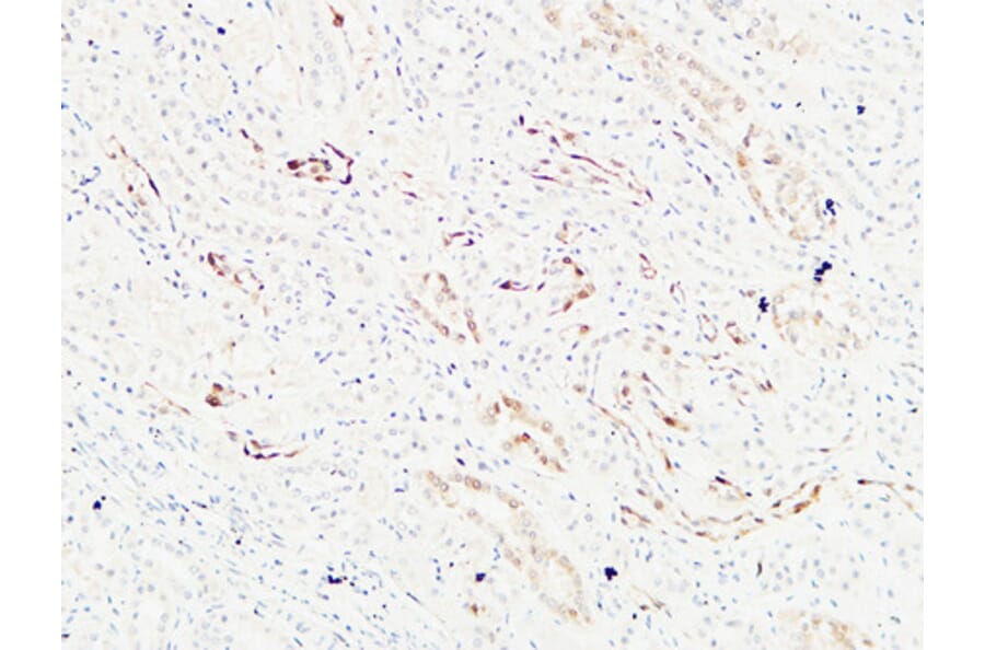 Immunohistochemistry - Anti-KRAS Antibody (C30060) - Antibodies.com