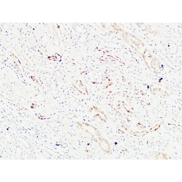 Immunohistochemistry - Anti-KRAS Antibody (C30060) - Antibodies.com