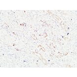 Immunohistochemistry - Anti-KRAS Antibody (C30060) - Antibodies.com
