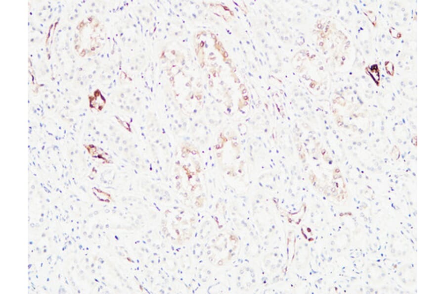 Immunohistochemistry - Anti-KRAS Antibody (C30060) - Antibodies.com