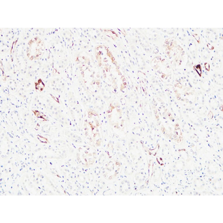 Immunohistochemistry - Anti-KRAS Antibody (C30060) - Antibodies.com