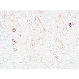 Immunohistochemistry - Anti-KRAS Antibody (C30060) - Antibodies.com