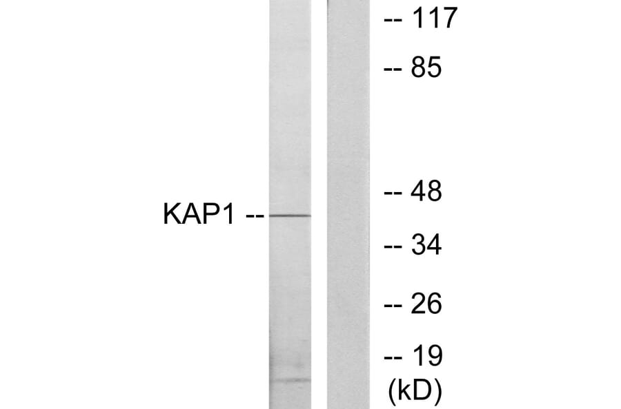 Western Blot - Anti-KAP1 Antibody (C10527) - Antibodies.com