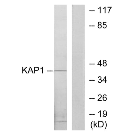 Western Blot - Anti-KAP1 Antibody (C10527) - Antibodies.com