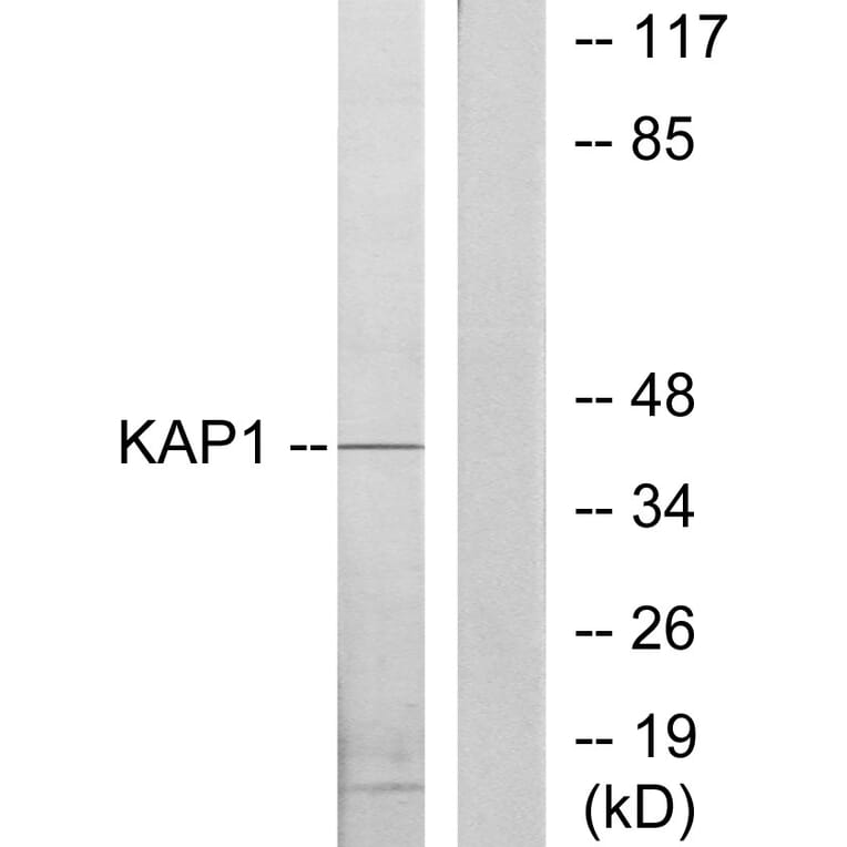 Western Blot - Anti-KAP1 Antibody (C10527) - Antibodies.com