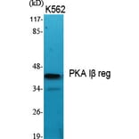 Western Blot - Anti-KAP1 Antibody (C10527) - Antibodies.com