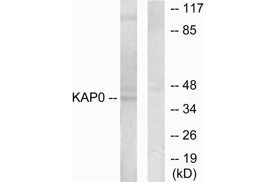 Western Blot - Anti-KAP0 Antibody (C10337) - Antibodies.com